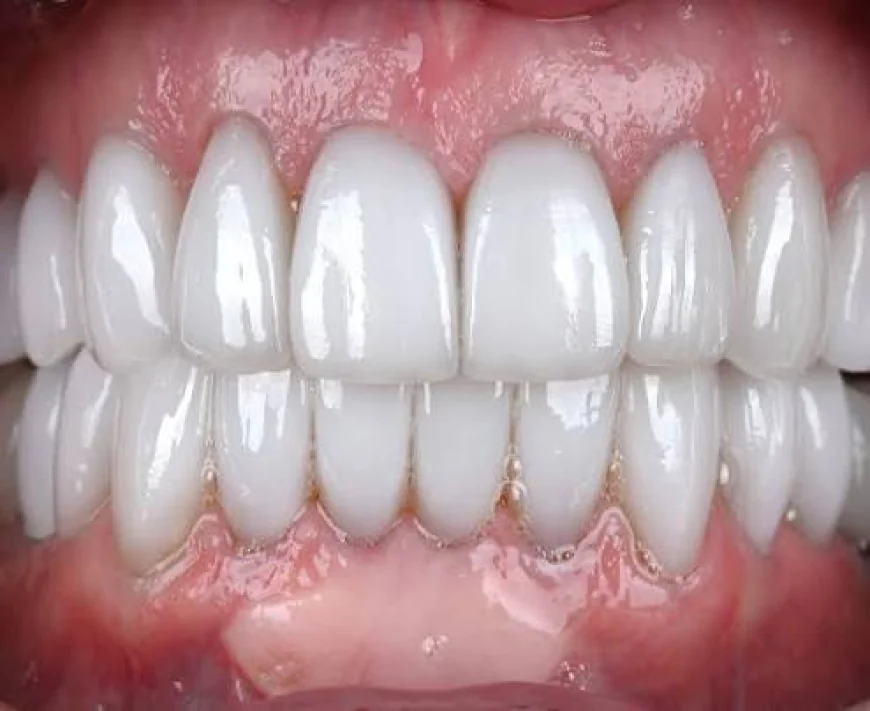 Rebuild Confidence with Advanced Smile Restoration in Houston