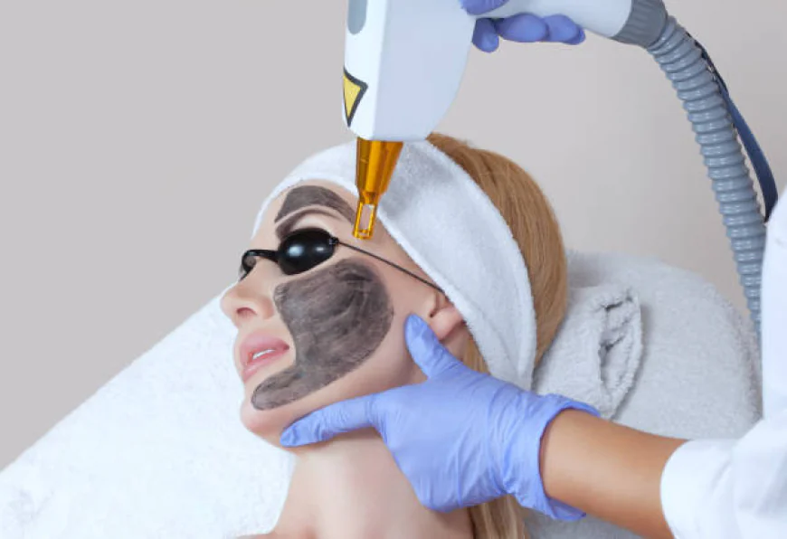 What makes Laser carbon peel effective for skin renewal?