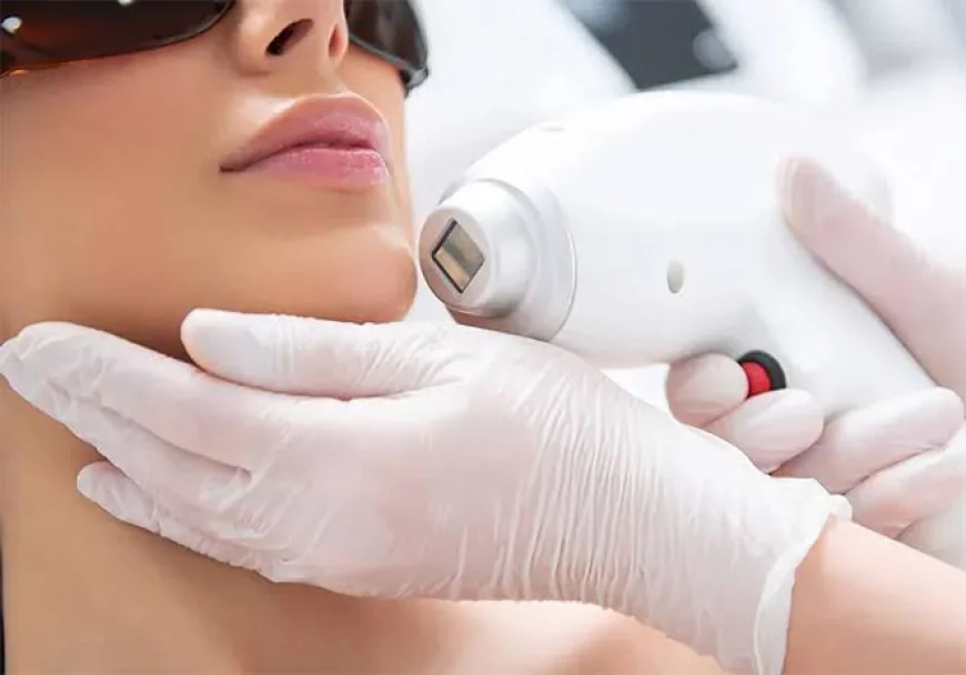 What Skin Concerns Can Laser Skin Resurfacing Treat?
