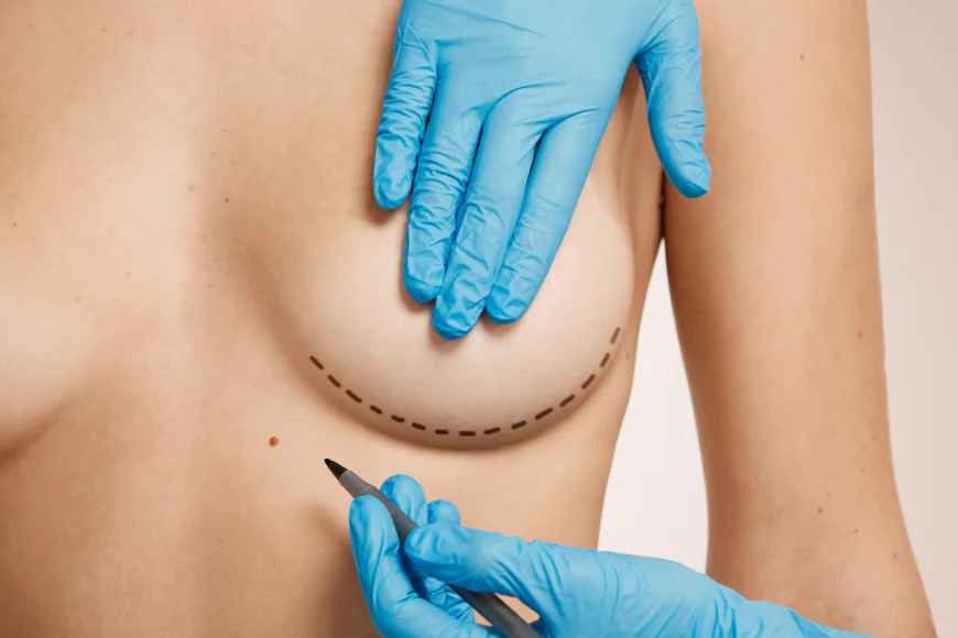 How Does Breast Implant Surgery Change Breast Shape?