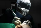 What Are Hair Transplant Side Effects? Everything You Need to Know Before Choosing the Best Hair Transplant in India