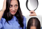 What Is the Best Hair Transplant? Cost Per Graft, Success Rate & Hair Transplant for Women Explained