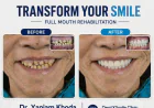Dental Implants Near Me — Single Tooth to Full Mouth Solutions