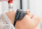 What makes Pico laser treatment different from other laser treatments?