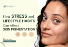 How Stress and Lifestyle Habits Can Affect Skin Pigmentation