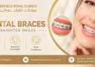 Who Is an Ideal Candidate for Dental Braces?