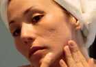 Is Acne Scar Treatment Right for Facial Texture Concerns?