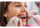 Braces in Dubai: A Complete Guide to Orthodontic Treatment