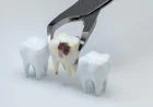 The Essential Guide to Tooth Extractions: Preparing for Your Dental Procedure