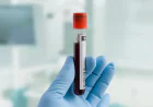 How Does a Cortisol Blood Test Work