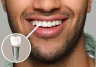 Dental Implants Sydney vs Traditional Tooth Replacement: Choosing Timeless Smiles Dental