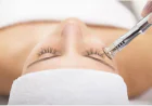 How Often Should You Get Microdermabrasion for Best Results?