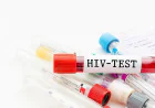 HIV Test in Dubai: Types and Testing Methods