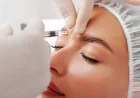 Discover Tailored Brow Refinement with Forehead Lift