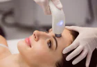 A Timeline of What to Expect After Laser Skin Treatment in Altamonte Springs