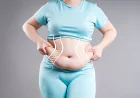 Enhance Your Abdominal Contours with Tummy Tuck