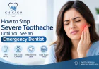 How to Stop Severe Toothache Until You See an Emergency Dentist
