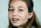 Orthodontic Headgear Treatment for Better Oral Alignment | Glamorous Clinic Dubai