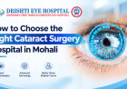 How to Choose the Right Cataract Surgery Hospital in Mohali