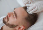 Hair Fall Problem? Know Your Treatment Options in Gurgaon