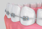 Modern Dental Care Solutions for Families in Houston, TX