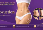 How Can Liposuction Refine Body Proportions?