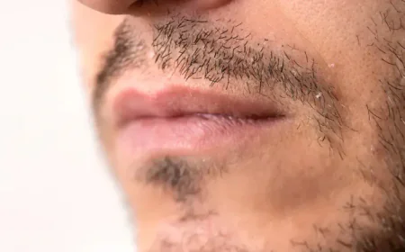 Can Mustache Hair Transplant Create a Thicker Mustache?