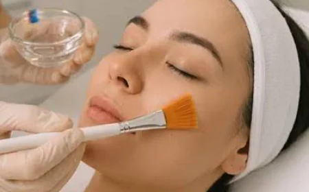 Can Glycolic Acid Peel Reduce Acne and Dark Spots Safely?