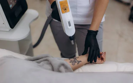 Does Laser Tattoo Removal work on colored tattoos