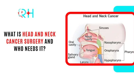 What Is Head and Neck Cancer Surgery and Who Needs It?