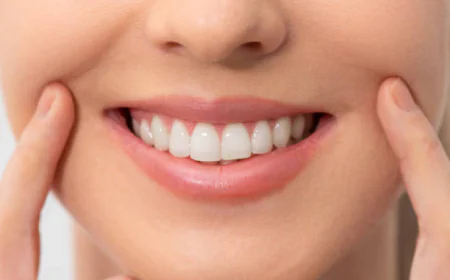 Is Teeth Whitening effective for stubborn food stains