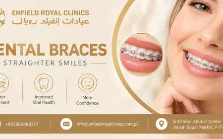 Who Is an Ideal Candidate for Dental Braces?
