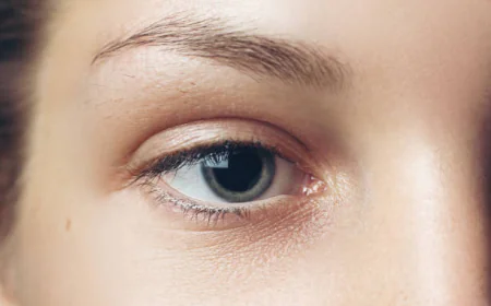 Is Eyelid Surgery Used for Puffy Lower Eyelids?