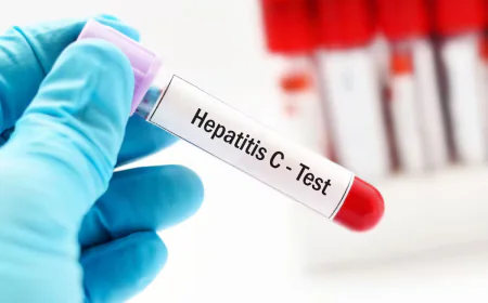 Common Reasons to Consider Hepatitis C Testing