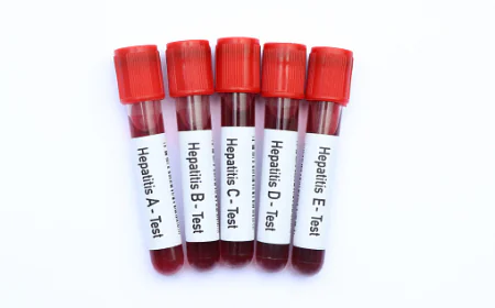 Common Reasons to Consider Hepatitis A Testing