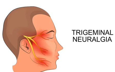 Trigeminal Neuralgia Treatment Al Ain: Diagnosis and Care