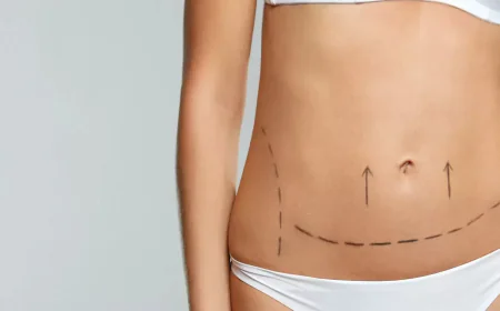 Is Lipo Abdominoplasty Suitable After Weight Loss?
