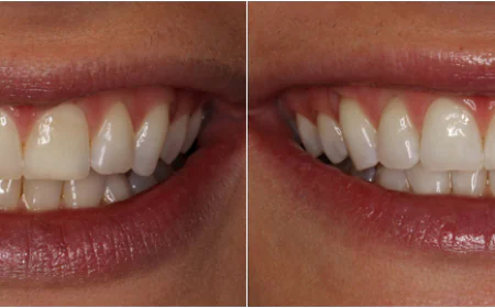 Why Preventive Dentistry Is Key to Affordable Family Dental Care