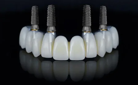 Those Considering All on 4 Brisbane Can Start with Hashtag Dentist