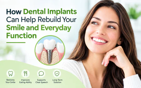 How Dental Implants Can Help Rebuild Your Smile and Everyday Function