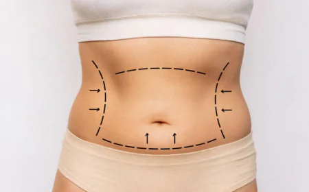 Who Is an Ideal Candidate for Mini Tummy Tuck ?