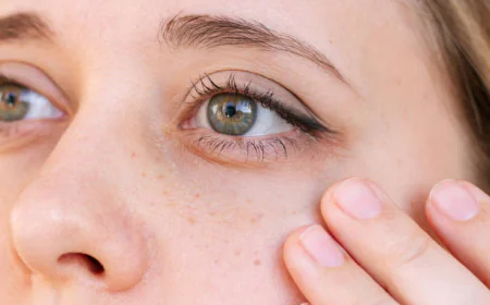 Can Under Eye Fillers soften dark under-eye shadows