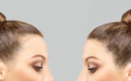 What Affects Natural-Looking Results After FUT Hair Transplant?