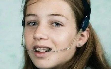Orthodontic Headgear Treatment for Better Oral Alignment | Glamorous Clinic Dubai