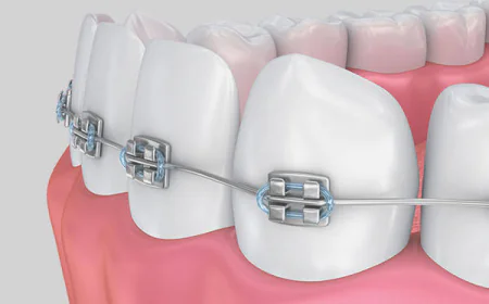 Modern Dental Care Solutions for Families in Houston, TX
