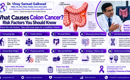 What Causes Colon Cancer? Risk Factors You Should Know