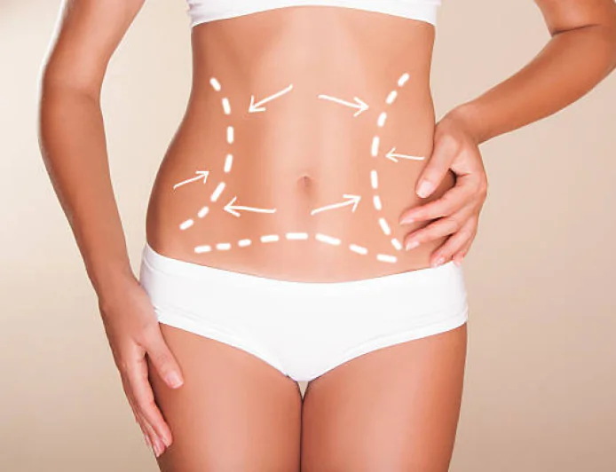 Does Liposuction cause swelling during recovery