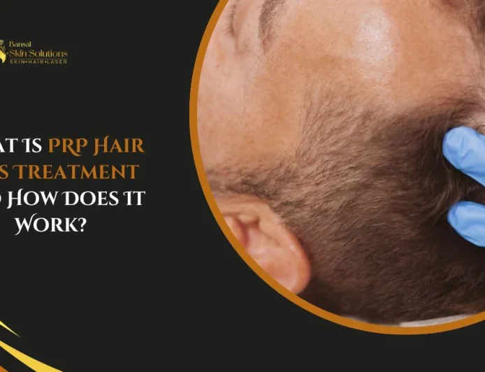 What Is PRP Hair Loss Treatment and How Does It Work?