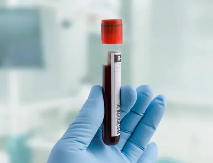 How Does a Cortisol Blood Test Work