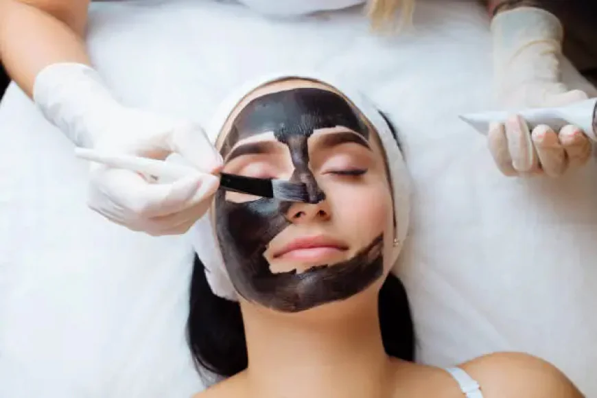 How Does Laser Carbon Peel Brighten Your Skin?